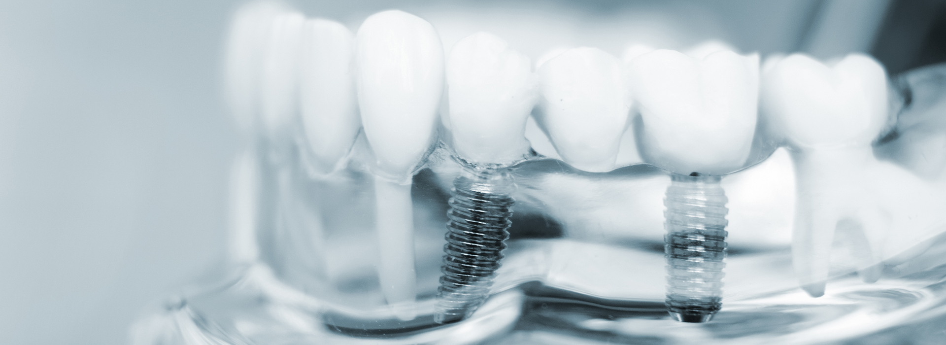 The image displays a close-up view of a transparent container filled with multiple toothbrush bristles, showcasing their individual components.