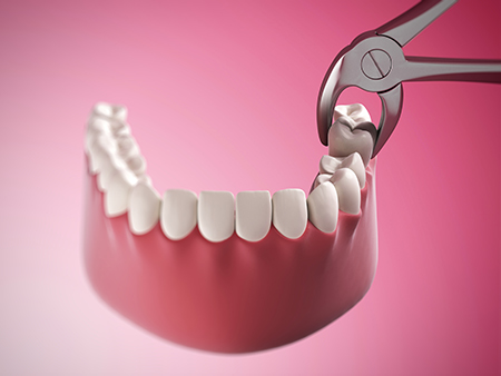 The image shows a pair of scissors with blades open, inserted into a dental implant with multiple teeth attached, against a pink background.