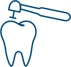 Dental Fillings