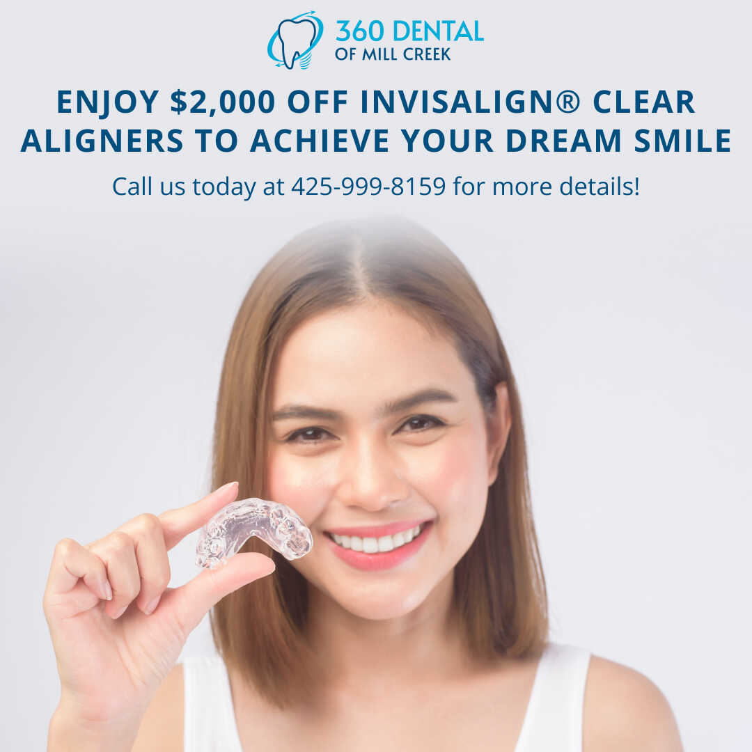 Invisalign Special